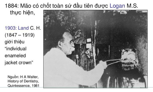 Sự thật ít người biết về mục đích ban đầu của răng sứ thẩm mỹ - Ảnh 1.