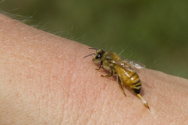 Xử lý khi bị côn trùng đốt đúng cách, tránh biến chứng đe dọa tính mạng - Ảnh 1.