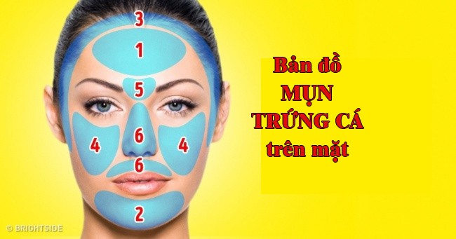 Nhìn bản đồ mụn trứng cá trên mặt để biết bộ phận nào trong cơ thể bạn đang gặp rắc rối - Ảnh 1.