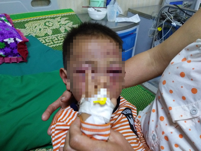 Vụ bé trai 2 tuổi bị bạo hành khiến nhập viện: Không truy cứu trách nhiệm hình sự cha dượng vì có tiền sử tâm thần - Ảnh 2.