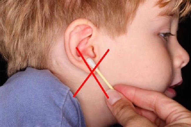Bác sĩ lấy ra cục ráy tai 9 năm từ tai bé gái, người mẹ bàng hoàng nhận ra sai lầm khi con mới 2 tuổi - Ảnh 4.
