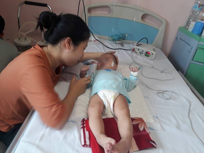  Nhờ y sỹ gần nhà tiêm thuốc chữa viêm phổi, bé 9 tháng nhập viện khẩn vì teo não - Ảnh 1.