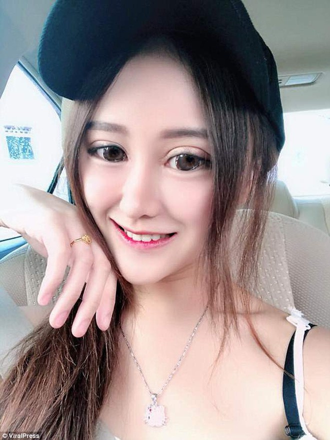 Đang yên lành nổi tiếng xinh xắn, hotgirl Instagram đi phẫu thuật thẩm mỹ cho giống búp bê để rồi fan chẳng nhận ra - Ảnh 3.