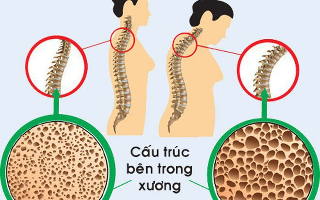  Chạm mốc 30, bạn sẽ phải đối mặt với 1 loạt thay đổi này trên cơ thể - Ảnh 7.