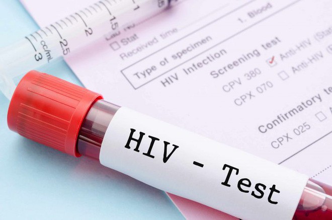 Tất cả những điều cần biết về HIV - căn bệnh thế kỉ chưa có thuốc chữa - Ảnh 8.
