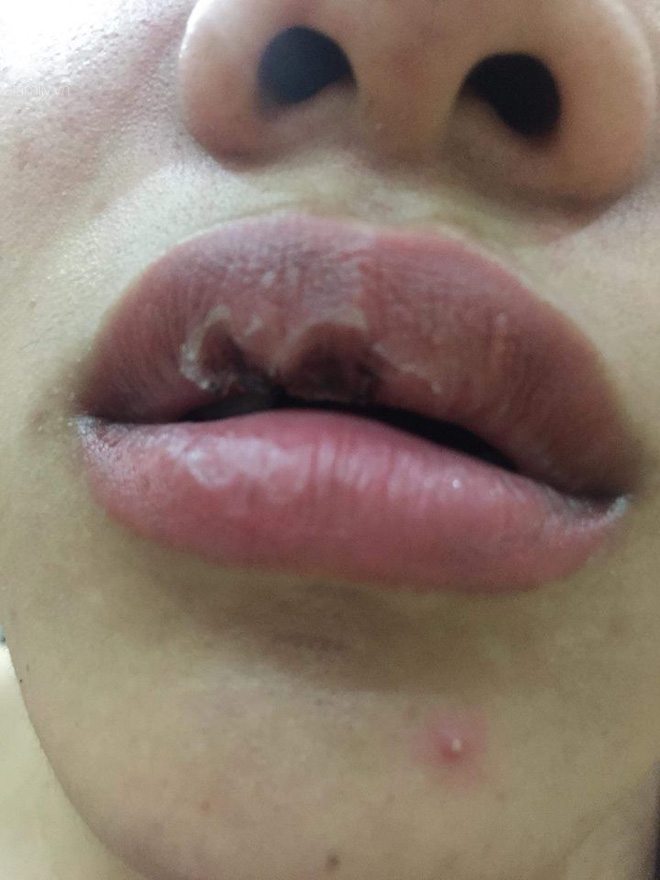 Hà Nội: Lời cầu cứu của cô gái bị bạn trai ngoại quốc đánh đập, tung clip nóng lên mạng - Ảnh 3.