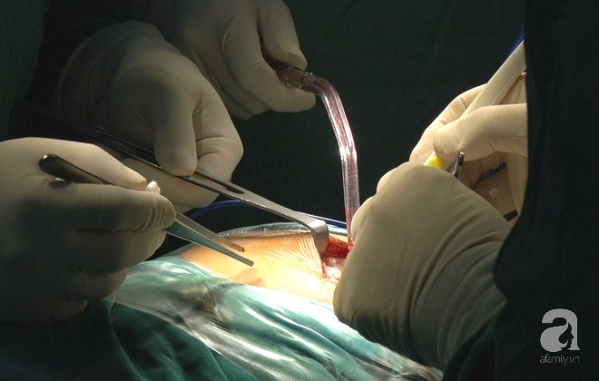 Bằng phương pháp này, bác sĩ Việt giúp người phụ nữ mang khối bướu ác tính ở xương đùi không phải tháo khớp - Ảnh 6.