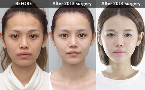 Từng 7 lần dao kéo liên tiếp trong một năm, nhan sắc của bà mẹ 2 con nghiện thẩm mỹ hiện tại trông ra sao - Ảnh 3.