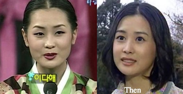 Những ca phẫu thuật thành công của mỹ nhân Hàn: Đúng là không có gì là không thể, một bước “vịt hóa thiên nga”, lọt top gương mặt đẹp nhất thế giới - Ảnh 9.