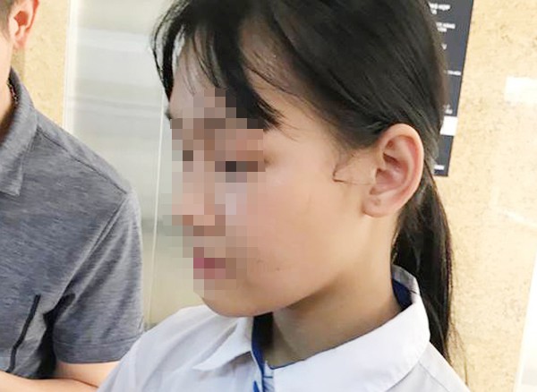 Vụ chồng dùng kéo đâm vợ cũ trọng thương: Con gái 15 tuổi nghẹn ngào kể lại giây phút mẹ bị bố tấn công - Ảnh 2.