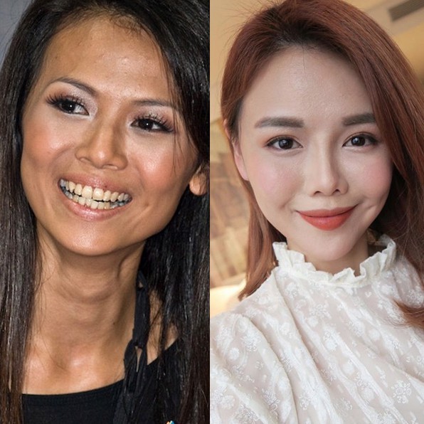 Từng 7 lần dao kéo liên tiếp trong một năm, nhan sắc của bà mẹ 2 con nghiện thẩm mỹ hiện tại trông ra sao - Ảnh 7.