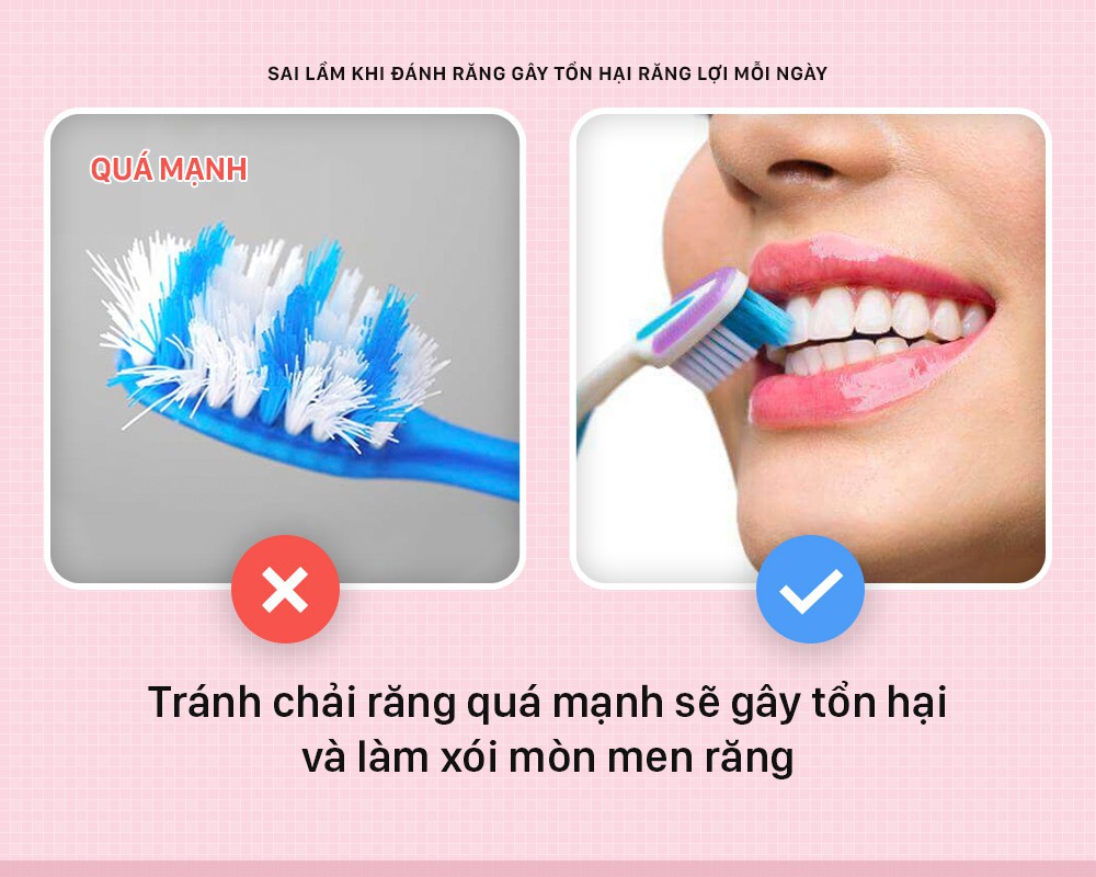 Gãy bàn chải đánh răng là gì? Nguyên nhân, tác hại và cách khắc phục hiệu quả