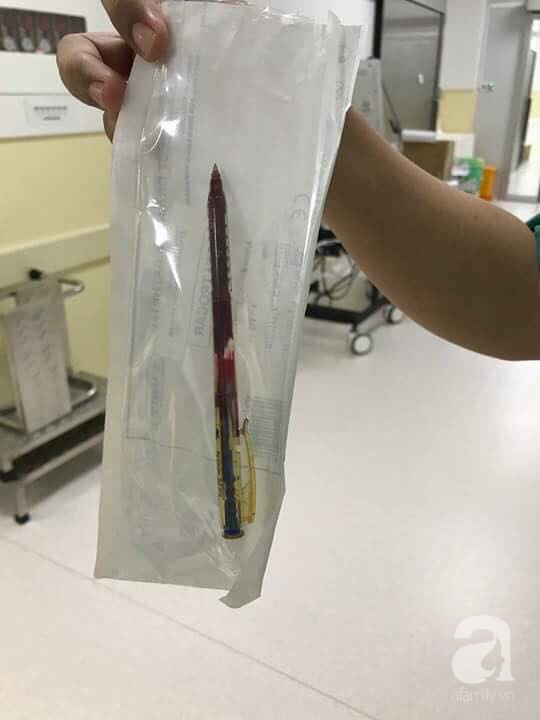 Cầm bút bi chạy chơi, bé gái 4 tuổi bị bút đâm xuyên thấu ngực - Ảnh 3.