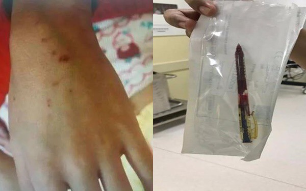 Trung Quốc: Giáo viên mầm non dùng bút đâm nhiều em nhỏ gây phẫn nộ - Ảnh 1.