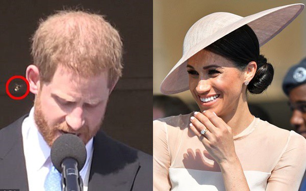 Hoàng tử Harry bị con ong quấy rầy trong lúc phát biểu và đây là hành động của công nương Meghan - Ảnh 3.