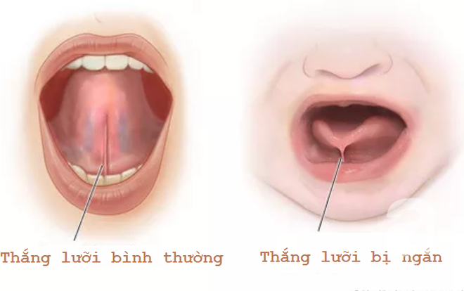 Thấy con cứ sụt cân sau khi sinh dù vẫn cho bú đầy đủ, bà mẹ bất ngờ khi biết nguyên nhân - Ảnh 7.