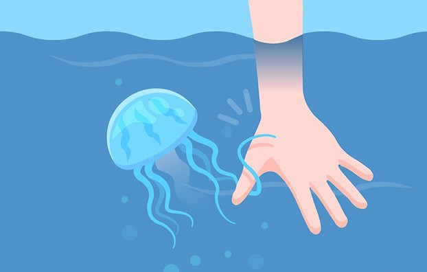 Nằm lòng cách xử lý khi bị sứa biển cắn – Bí quyết xử lý đúng, kịp thời bất cứ ai cũng cần trau dồi vào mùa đi biển - Ảnh 3.
