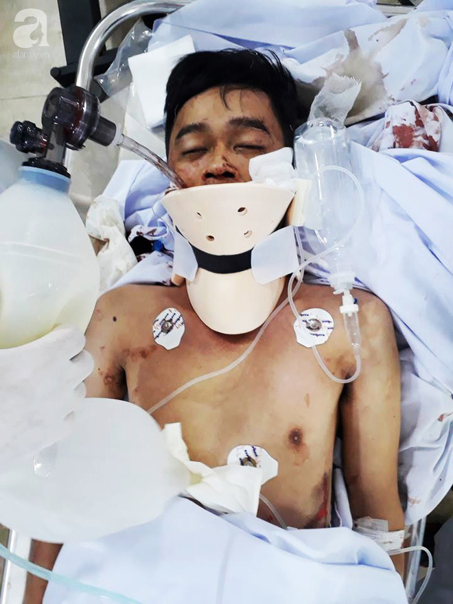 Bệnh viện quận Thủ Đức (TP.HCM) tìm người thân cho chàng trai bị tai nạn nguy kịch - Ảnh 1.