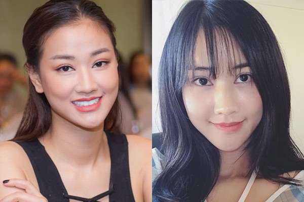 Nhan sắc vốn đã xinh, nhưng 4 bà mẹ này vẫn quyết chọn phẫu thuật thẩm mỹ để trở nên đẹp hơn - Ảnh 13.