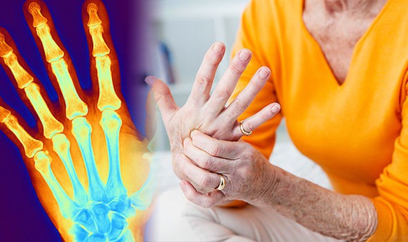 Hãy tạo cho mình những thói quen này hàng ngày để ngăn ngừa các triệu chứng đau khớp ở đầu gối, hông và bàn tay - Ảnh 1. Hãy tạo cho mình những thói quen này hàng ngày để ngăn ngừa các triệu chứng đau khớp ở đầu gối, hông và bàn tay - Ảnh 1.