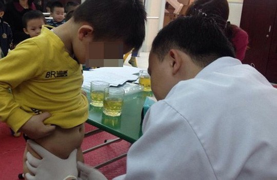 Hi hữu 3 anh em ruột c&ugrave;ng mang bộ phận sinh dục bất thường - Ảnh 2.
