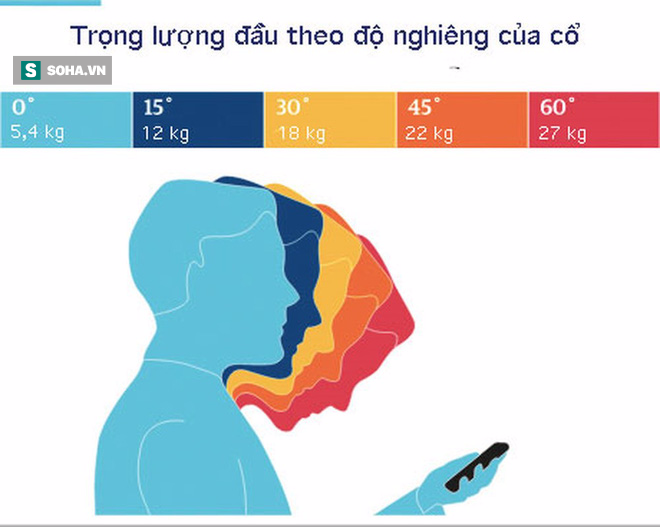 Cảnh báo: Bé 9 tuổi biến dạng xương cổ do xem điện thoại, cha mẹ phát hiện thì đã quá muộn - Ảnh 3.