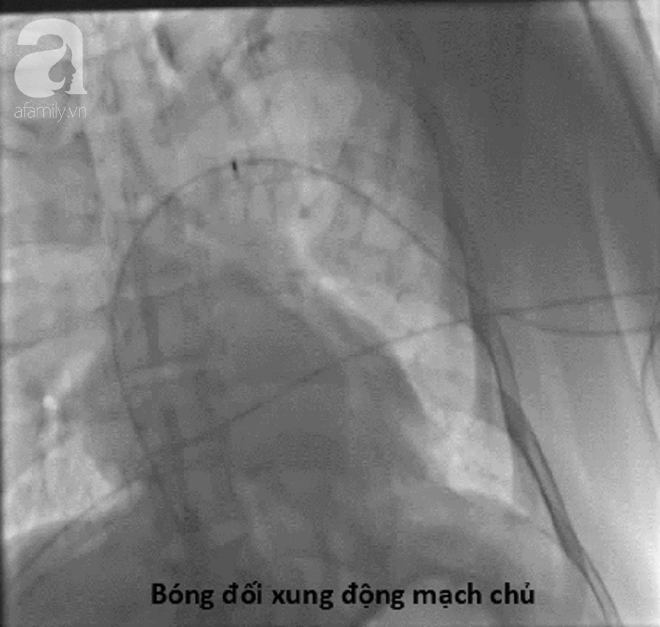 Bác sĩ Sài Gòn ròng rã đưa người đàn ông 3 lần ngưng tim từ cõi chết trở về bằng kỹ thuật gấu ngủ đông - Ảnh 4.