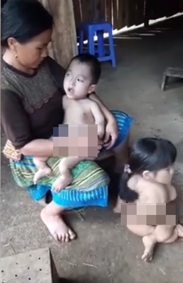 Điện Biên: Cảnh khốn cùng của gia đình dân tộc H’Mông có 3 chị em bị bệnh hiểm nghèo bị đồn do hôn nhân cận huyết - Ảnh 2.