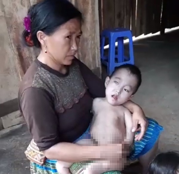 Điện Biên: Cảnh khốn cùng của gia đình dân tộc H’Mông có 3 chị em bị bệnh hiểm nghèo bị đồn do hôn nhân cận huyết - Ảnh 1.