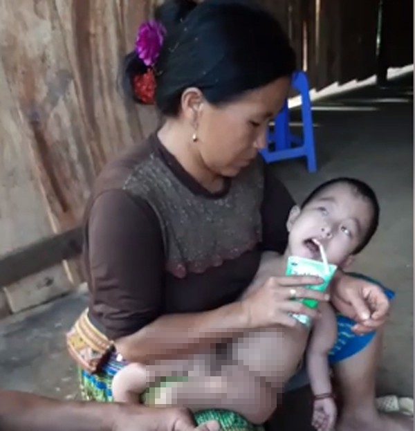 Điện Biên: Cảnh khốn cùng của gia đình dân tộc H’Mông có 3 chị em bị bệnh hiểm nghèo bị đồn do hôn nhân cận huyết - Ảnh 3.