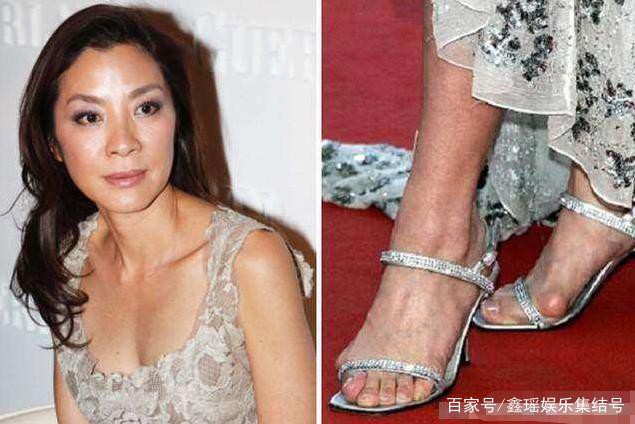 Xinh đẹp là vậy nhưng dàn mỹ nhân Hoa ngữ lại khiến dân tình bị sốc với bàn chân biến dạng vì giày cao gót - Ảnh 9.
