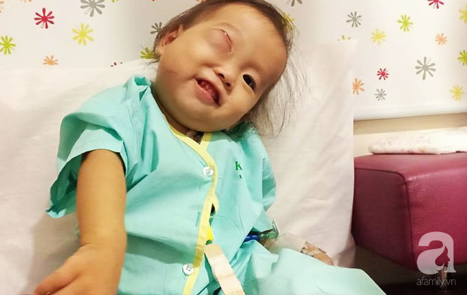 Em bé 2 tuổi ở Cà Mau bị u mắt nguy hiểm, bố mẹ nghèo cố tìm cách cứu con trong tuyệt vọng - Ảnh 7.