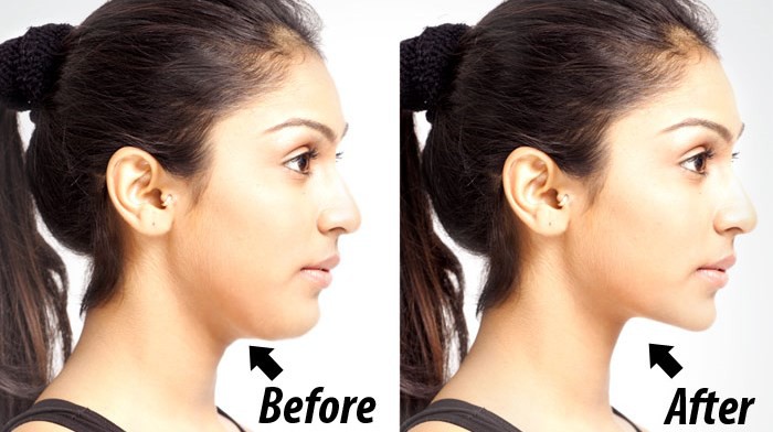 5 c&aacute;ch tự nhi&ecirc;n để tho&aacute;t khỏi t&igrave;nh trạng mỡ ở cổ - Ảnh 12.