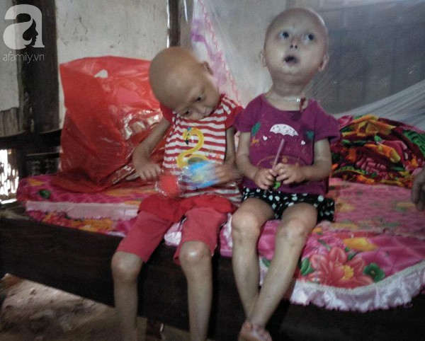 Niềm vui, niềm hi vọng lóe sáng đến với 2 bé gái bị nghẹo đầu tựa người ngoài hành tinh ở Tuyên Quang - Ảnh 3.