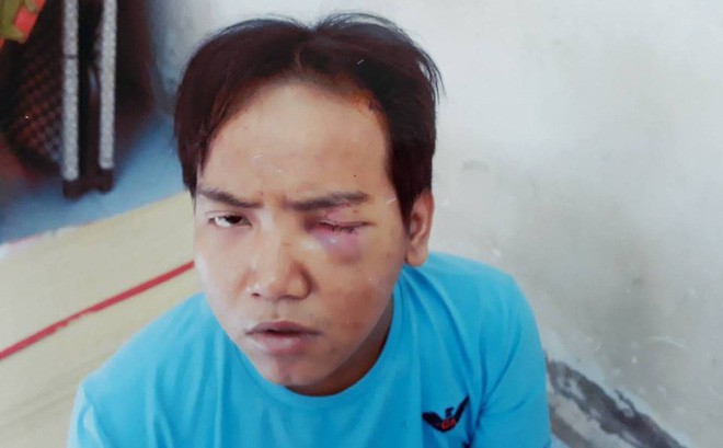 Cắt cổ bé trai 6 tuổi, nam bảo vệ dân phố được đình chỉ điều tra vì mắc bệnh tâm thần phân liệt - Ảnh 1. Cắt cổ bé trai 6 tuổi, nam bảo vệ dân phố được đình chỉ điều tra vì mắc bệnh tâm thần phân liệt - Ảnh 1.
