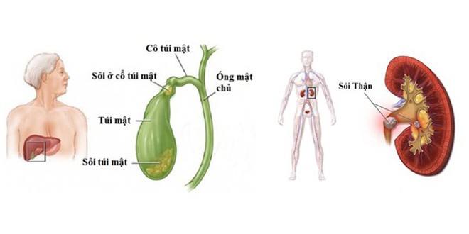 3 thói quen trong bữa tối đang nuôi lớn nhiều căn bệnh nguy hiểm: Hãy sớm tránh xa! - Ảnh 2. 3 thói quen trong bữa tối đang nuôi lớn nhiều căn bệnh nguy hiểm: Hãy sớm tránh xa! - Ảnh 2.