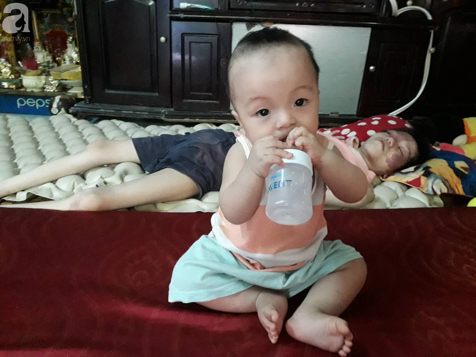 Đà Nẵng: Người mẹ nghèo nuôi 3 con thơ nheo nhóc, bất lực nhìn con gái 15 tuổi co giật vì bệnh u máu quái ác - Ảnh 8. Đà Nẵng: Người mẹ nghèo nuôi 3 con thơ nheo nhóc, bất lực nhìn con gái 15 tuổi co giật vì bệnh u máu quái ác - Ảnh 8.