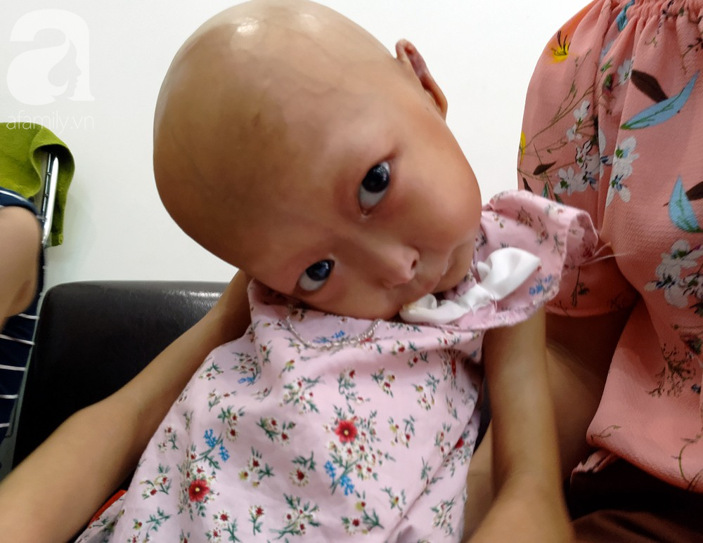 Mẹ của 2 bé gái bị đầu, cổ vẹo lệch ở Tuyên Quang: Giá như con khỏi bệnh, dù đánh đổi gì tôi cũng cam lòng - Ảnh 12.