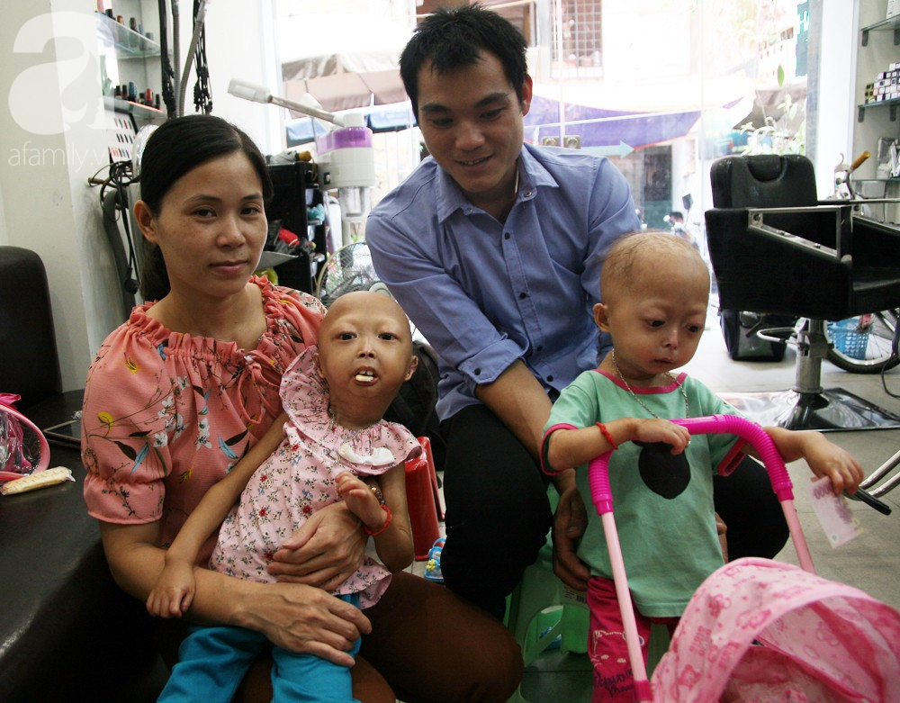 Mẹ của 2 bé gái bị đầu, cổ vẹo lệch ở Tuyên Quang: Giá như con khỏi bệnh, dù đánh đổi gì tôi cũng cam lòng - Ảnh 3.