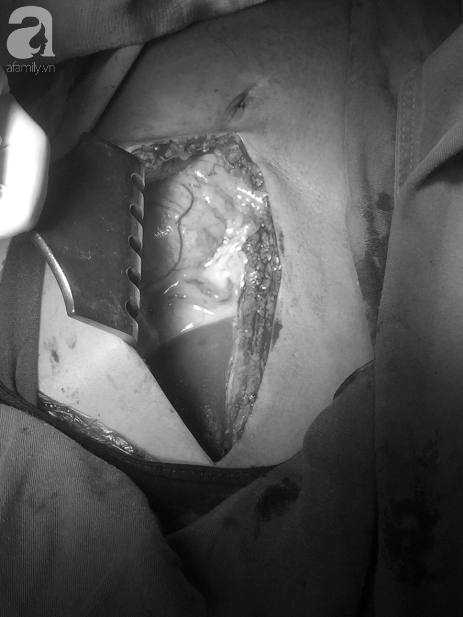Đang nằm trong bệnh viện, người đàn ông bất ngờ dùng kéo đâm 5 nhát vào tim mình - Ảnh 3.