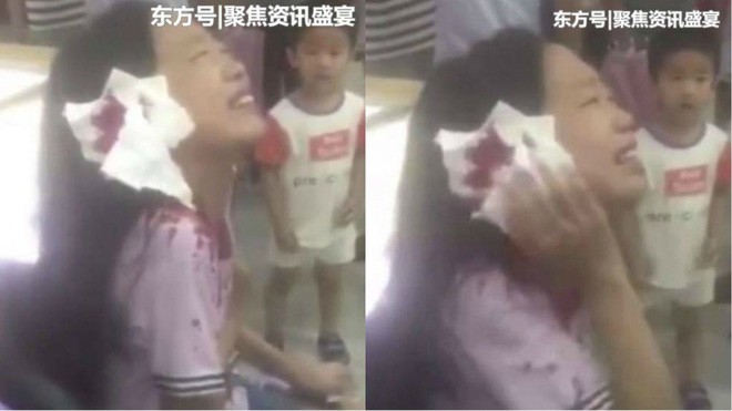 Trung Quốc: Bị kéo lê cả mét sau khi đầu bị kẹp giữa tay vịn thang cuốn và bức tường, bé gái may mắn thoát chết trong gang tấc - Ảnh 4.
