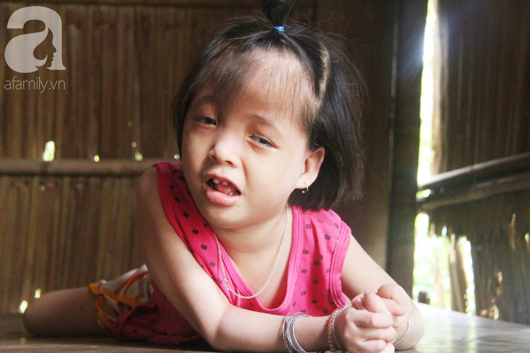 Xót cảnh bé gái 7 tuổi bị não úng thủy, suốt ngày chỉ biết lết theo mẹ xin ăn cơm mà không có tiền đi bệnh viện chữa trị - Ảnh 3.