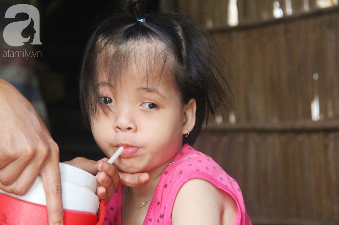 Xót cảnh bé gái 7 tuổi bị não úng thủy, suốt ngày chỉ biết lết theo mẹ xin ăn cơm mà không có tiền đi bệnh viện chữa trị - Ảnh 5.