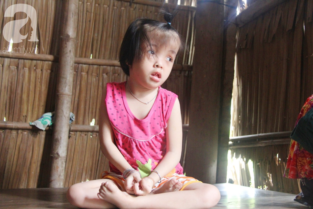 Xót cảnh bé gái 7 tuổi bị não úng thủy, suốt ngày chỉ biết lết theo mẹ xin ăn cơm mà không có tiền đi bệnh viện chữa trị - Ảnh 4.