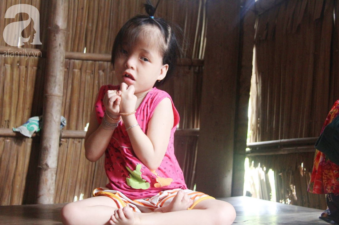 Xót cảnh bé gái 7 tuổi bị não úng thủy, suốt ngày chỉ biết lết theo mẹ xin ăn cơm mà không có tiền đi bệnh viện chữa trị - Ảnh 7.