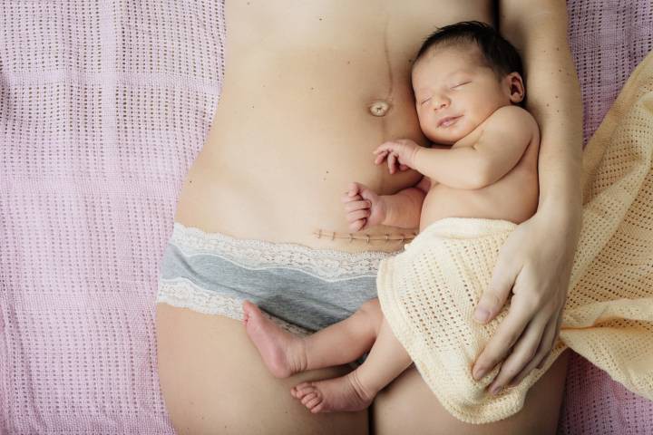 Mẹ sinh mổ phải lưu ý 4 điều này để cơ thể nhanh chóng phục hồi sau sinh - Ảnh 3.