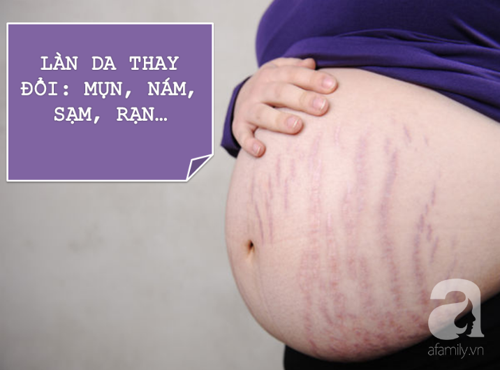 Chưa chắc mẹ bầu đã biết hết những thay đổi từ đầu đến chân của cơ thể khi mang thai  - Ảnh 3.