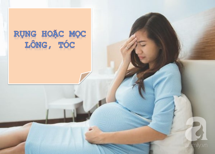Chưa chắc mẹ bầu đã biết hết những thay đổi từ đầu đến chân của cơ thể khi mang thai - Ảnh 4. Chưa chắc mẹ bầu đã biết hết những thay đổi từ đầu đến chân của cơ thể khi mang thai - Ảnh 4.