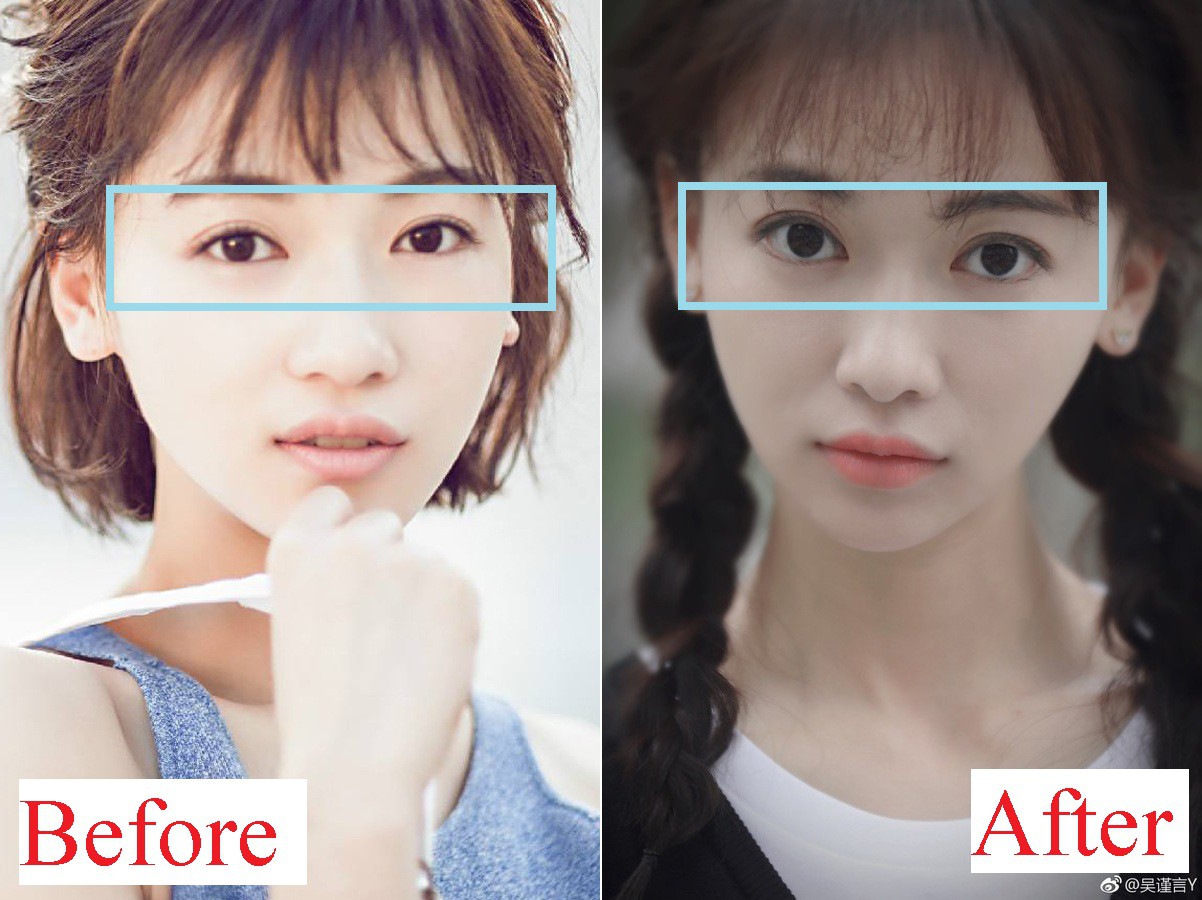 Thay đổi nhan sắc đến ngỡ ngàng như “Ngụy Anh Lạc” Ngô Cẩn Ngôn: Là dậy thì thành công hay nhờ phẫu thuật thẩm mỹ? - Ảnh 13. Thay đổi nhan sắc đến ngỡ ngàng như “Ngụy Anh Lạc” Ngô Cẩn Ngôn: Là dậy thì thành công hay nhờ phẫu thuật thẩm mỹ? - Ảnh 13.