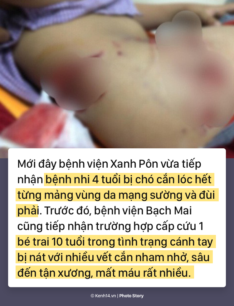 Trước liên tiếp những vụ chó tấn công trẻ em gần đây, tìm hiểu cách sơ cứu vết thương kịp thời - Ảnh 1.